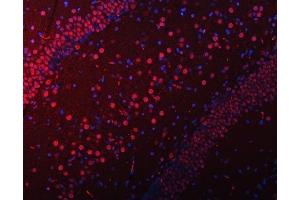 anti-Small Nuclear Ribonucleoprotein Polypeptide N (SNRPN) (AA 11-39), (N-Term) antibody