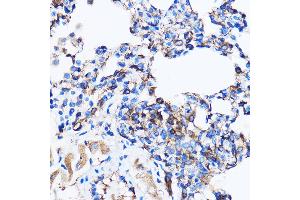 Immunohistochemistry of paraffin-embedded Rat lung using p38 MAPK Rabbit pAb (ABIN7268615) at dilution of 1:100 (40x lens). (MAPK14 antibody  (AA 1-360))
