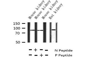 Western blot analysis of Phospho-Tau (Ser404) expression in various lysates (MAPT antibody  (pSer404))
