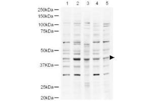 Image no. 1 for anti-Ubiquitin Specific Peptidase 18 (USP18) (AA 40-49) antibody (ABIN401252) (USP18 antibody  (AA 40-49))