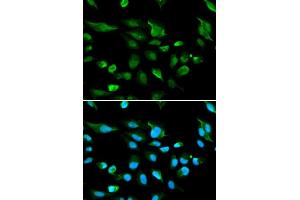 Immunofluorescence analysis of A549 cell using AIRE antibody. (AIRE antibody  (AA 30-130))