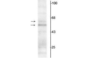 Western blot of rat hippocampal lysate showing specific immunolabeling of the ~50 kDa TR-α1 and the ~58 kDa TR-α2 protein. (THRA antibody  (N-Term))