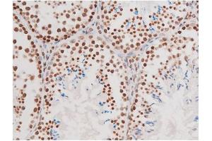 Immunohistochemistry (IHC) image for anti-Nuclear Factor-kB p65 (NFkBP65) (pThr435) antibody (ABIN6255688)