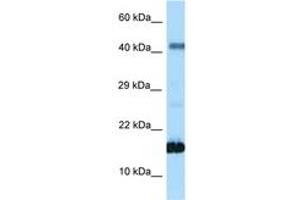 Image no. 1 for anti-Somatostatin (SST) (AA 35-84) antibody (ABIN6748033) (Somatostatin antibody  (AA 35-84))