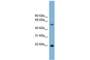 Image no. 1 for anti-Hepatoma-Derived Growth Factor-Related Protein 3 (HDGFRP3) (C-Term) antibody (ABIN6746474) (HDGFRP3 antibody  (C-Term))