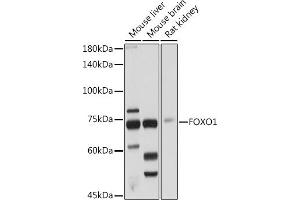 Western blot analysis of extracts of various cell lines, using FOXO1 antibody (ABIN3017007, ABIN3017008, ABIN3017009 and ABIN6219920) at 1:1000 dilution. (FOXO1 antibody)