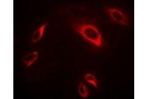 Immunofluorescent analysis of TRAF2 staining in Hela cells.
