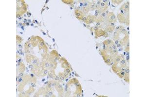 Immunohistochemistry of paraffin-embedded Human stomach using ATP2C1 Polyclonal Antibody at dilution of 1:100 (40x lens).