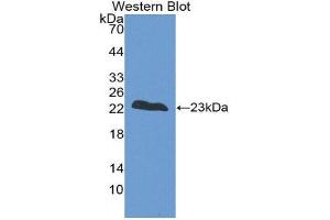 Western Blotting (WB) image for anti-Fast Skeletal Troponin I (TNNI2) (AA 1-182) antibody (ABIN1860816) (TNNI2 antibody  (AA 1-182))