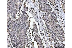 IHC analysis of PC4/SUB1 using anti-PC4/SUB1 antibody (ABIN4886733). (SUB1 antibody  (C-Term))