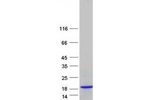 Validation with Western Blot (S100A13 Protein (Transcript Variant 5) (Myc-DYKDDDDK Tag))