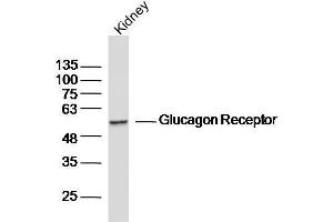 Mouse kidney lysates probed with Glucagon Receptor Polyclonal Antibody, unconjugated  at 1:300 overnight at 4°C followed by a conjugated secondary antibody for 60 minutes at 37°C. (Glucagon Receptor antibody  (AA 11-110))
