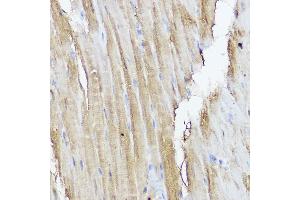 Immunohistochemistry of paraffin-embedded mouse heart using ST Rabbit pAb (ABIN7270304) at dilution of 1:50 (40x lens). (STAT2 antibody  (AA 650-750))
