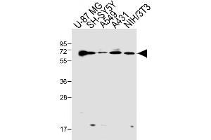 All lanes : Anti-Epsin2/1 Antibody (N-term) at 1:1000 dilution Lane 1: U-87 MG whole cell lysate Lane 2: SH-SY5Y whole cell lysate Lane 3: A549 whole cell lysate Lane 4: A431 whole cell lysate Lane 5: NIH/3T3 whole cell lysate Lysates/proteins at 20 μg per lane.