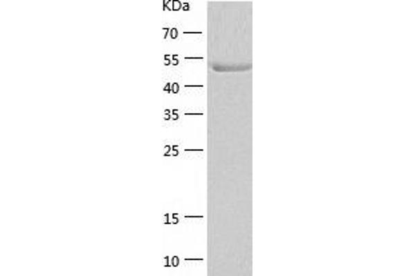 GCK Protein (AA 1-465) (His tag)