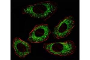 Fluorescent image of A549 cell stained with anti-Src antibody at 1:25.