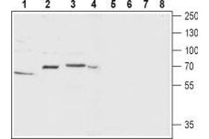 Western blot analysis of rat ovary (lanes 1 and 5), rat brain (lanes 2 and 6), mouse brain membrane (lanes 3 and 7) and SH-SY5Y (lanes 4 and 8) lysate: - 1-4.