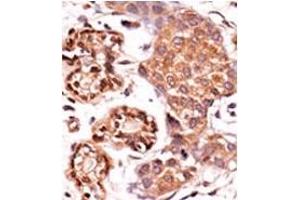 Image no. 2 for anti-ABL2 (ABL2) (Middle Region) antibody (ABIN358072)