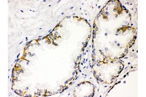 Anti- CD46 Picoband antibody, IHC(P) IHC(P): Human Prostatic Cancer Tissue