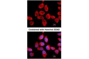 ICC/IF Image Immunofluorescence analysis of methanol-fixed A431, using RPLP2, antibody at 1:500 dilution. (RPLP2 antibody  (Center))