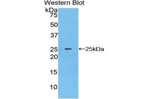 Western Blotting (WB) image for anti-Cathepsin K (CTSK) (AA 116-329) antibody (ABIN1077922) (Cathepsin K antibody  (AA 116-329))