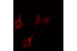 ABIN6274043 staining HepG2 by IF/ICC. (RhoA,B,C antibody)