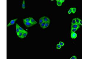 Immunofluorescent analysis of HepG2 cells using ABIN7146170 at dilution of 1:100 and Alexa Fluor 488-congugated AffiniPure Goat Anti-Rabbit IgG(H+L) (C5AR1 antibody  (AA 1-36))