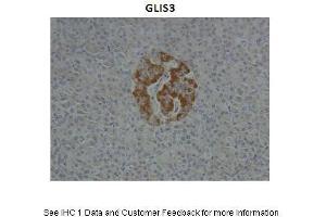 Sample Type :  Human Pancreas  Primary Antibody Dilution :  1:10  Secondary Antibody :  Anti-rabbit HRP  Secondary Antibody Dilution :  1:1000  Gene Name :  GLIS3  Submitted by :  Anonymous (GLIS3 antibody  (N-Term))