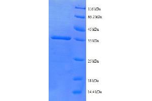 Chemokine (C-X-C Motif) Ligand 5 (CXCL5) (AA 37-110), (partial) protein (GST tag) (CXCL5 Protein (AA 37-110, partial) (GST tag))