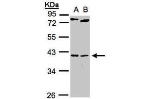 WB Image Sample(30 ug whole cell lysate) A:H1299 B:Raji , 10% SDS PAGE antibody diluted at 1:1000 (NK2 Homeobox 5 antibody)