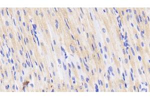 Detection of CD40L in Porcine Cardiac Muscle Tissue using Polyclonal Antibody to Cluster Of Differentiation 40 Ligand (CD40L) (CD40 Ligand antibody  (AA 111-261))