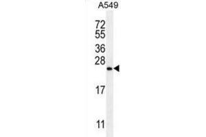 Western Blotting (WB) image for anti-Sorting Nexin 24 (SNX24) antibody (ABIN2996266) (SNX24 antibody)