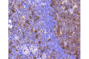 Paraformaldehyde-fixed, paraffin embedded human tonsil section, Antigen retrieval by boiling in sodium citrate buffer (pH6) for 15min, Block endogenous peroxidase by 3% hydrogen peroxide for 30 minutes, Blocking buffer (normal serum) at 37°C for 20min, Antibody incubation with Cdk6 (4F7) Monoclonal Antibody  at 1:50 overnight at 4°C, followed by a conjugated secondary and DAB staining. (CDK6 antibody)