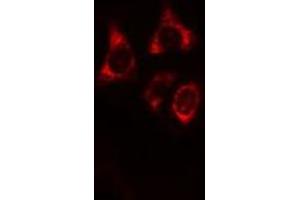 ABIN6269358 staining HeLa cells by IF/ICC. (IRF3 antibody  (C-Term))