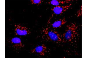 Proximity Ligation Analysis of protein-protein interactions between TP53 and SMAD2. (SMAD2 antibody  (AA 16-119))