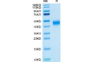 Human MXRA8 on Tris-Bis PAGE under reduced condition. (MXRA8 Protein (AA 20-341) (His tag))