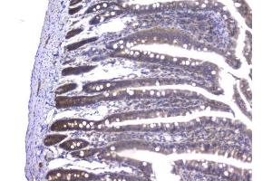 IHC analysis of PPID using anti-PPID antibody (ABIN6719438).
