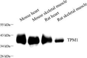 Western blot analysis of TPM1 (ABIN7076030),at dilution of 1: 400 (Tropomyosin antibody)
