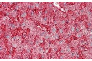 Immunohistochemistry (IHC) image for anti-Annexin A4 (ANXA4) (AA 11-164) antibody (ABIN7435871)