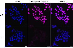 Immunocytochemical staining of Hela cells using Checkpoint kinase 2 antibody (ABIN7798039), 1:1,000), Top panel: wild-type (WT), Bottom panal: Checkpoint kinase 2 shRNA knockdown (KD). (Recombinant CHEK2 antibody)