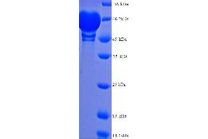 SDS-PAGE (SDS) image for Matrix Metallopeptidase 9 (Gelatinase B, 92kDa Gelatinase, 92kDa Type IV Collagenase) (MMP9) (AA 107-707) protein (His tag) (ABIN5713658) (MMP 9 Protein (AA 107-707) (His tag))