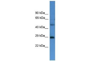 WB Suggested Anti-SPR  Antibody Titration: 0. (SPR antibody  (C-Term))