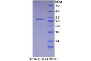 SDS-PAGE (SDS) image for Integrin alpha D (ITGAD) (AA 879-1099) protein (His tag) (ABIN2125319)
