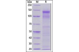 Biotinylated Human LDL R, His,Avitag on  under reducing (R) condition. (LDLR Protein (AA 22-788) (His tag,AVI tag,Biotin))