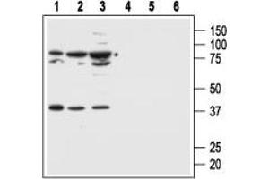 Western Blotting (WB) image for anti-Melanocortin 1 Receptor (MC1R) (AA 217-232) antibody (ABIN7043321)
