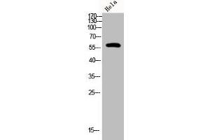 Western Blot analysis of Hela cells using Phospho-PFK-2 car (S483) Polyclonal Antibody (PFKFB2 antibody  (pSer483))