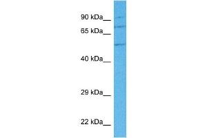 Host:  Rabbit  Target Name:  ANXA7  Sample Tissue:  Human 786-0 Whole Cell  Antibody Dilution:  1ug/ml (Annexin VII antibody  (N-Term))