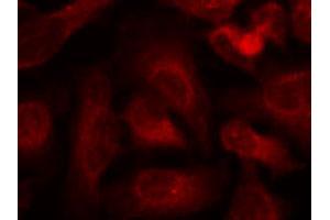 Immunofluorescence staining of methanol-fixed HeLa cells using ABL1/ABL2 (phospho Y393/429) polyclonal antibody (Cat # PAB12190, red).