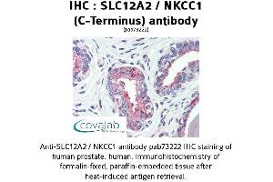 Image no. 1 for anti-Solute Carrier Family 12 (Potassium-Chloride Transporter) Member 2 (SLC12A2) (C-Term) antibody (ABIN1739325) (SLC12A2 antibody  (C-Term))