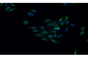 Detection of CTSK in Human HepG2 cell using Monoclonal Antibody to Cathepsin K (CTSK) (Cathepsin K antibody  (AA 115-329))
